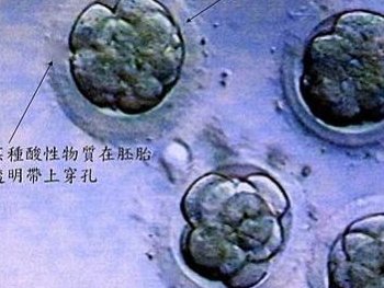 什么是染色体平衡易位？染色体平衡易位有什么影响？染色体平衡易位需要做试管婴儿吗？